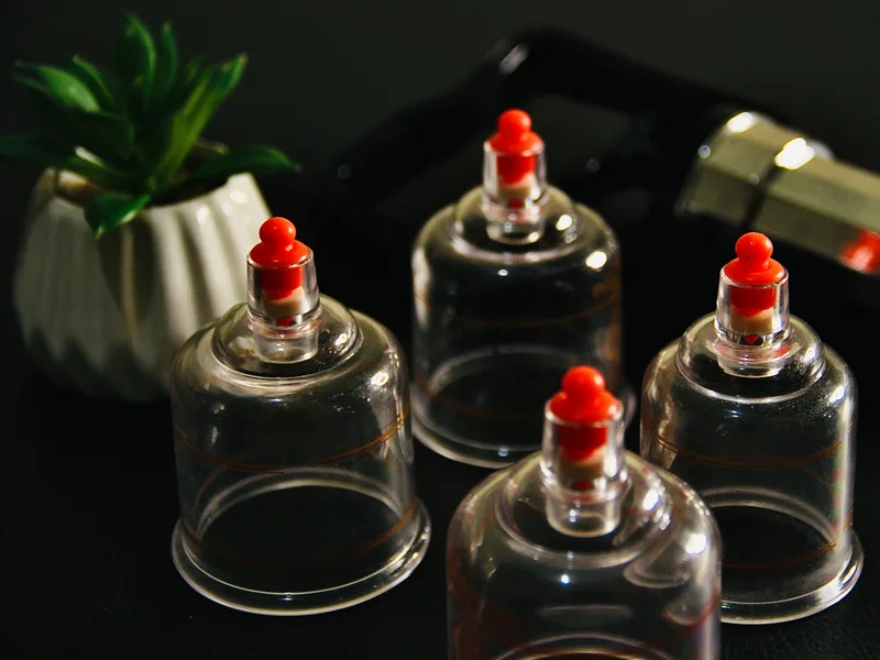 How Cupping Therapy works at Essential Life Chiropractic