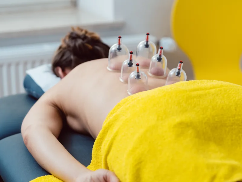 Cupping Therapy at Essential Life Chiropractic in Freehold