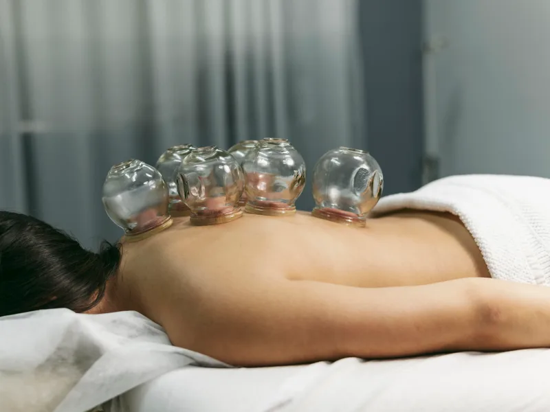 Cupping Therapy at Essential Life Chiropractic in Freehold