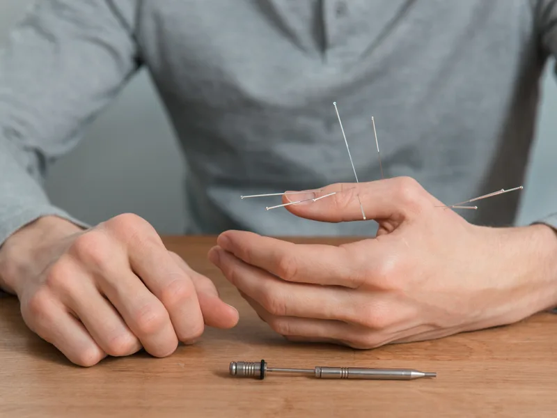 Dry Needling at Essential Life Chiropractic in Freehold