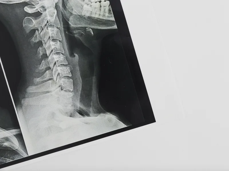 X-Rays at Essential Life Chiropractic in Freehold